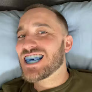 Protector Bucal - Antirronquidos 😴 y Antibruxismo 🦷